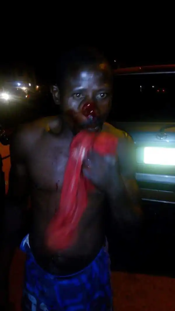 Hausa Man Stabs Igbo Man In Enugu With Dagger Over N50 (Photos)